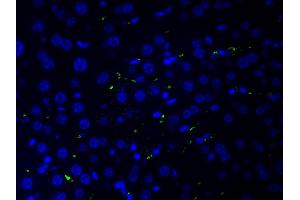 ABIN6266515 at 1/200 staining human liver tissue cells by ICC/IF. (COL2A1 anticorps  (N-Term))