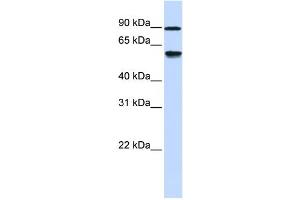 Western Blotting (WB) image for anti-Alcohol Dehydrogenase, Iron Containing, 1 (ADHFE1) antibody (ABIN2459564) (ADHFE1 anticorps)