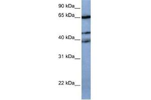 Western Blot showing ZNF681 antibody used at a concentration of 1-2 ug/ml to detect its target protein. (ZNF681 anticorps  (N-Term))