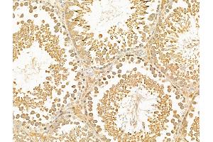 ABIN7094886 and ABIN7098939 at 1/100 staining Rat testis tissue by IHC-P.
