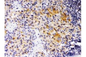 IHC analysis of SKAP55 using anti-SKAP55 antibody (ABIN3044545). (SKAP1 anticorps  (Middle Region))