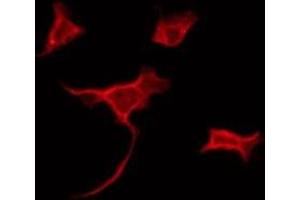 ABIN6275156 staining Hela by IF/ICC. (GLRB anticorps  (Internal Region))