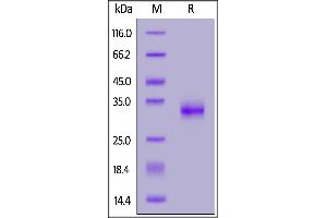 SARS-CoV-2 S protein RBD (K417T, E484K, N501Y), His Tag on  under reducing (R) condition. (SARS-CoV-2 Spike Protein (P.1 - gamma) (His tag))