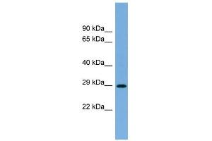 WB Suggested Anti-RAB40C Antibody Titration: 0. (RAB40C anticorps  (N-Term))