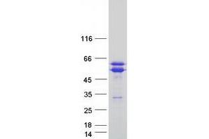 Validation with Western Blot