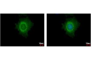 ICC/IF Image DDX6 antibody detects DDX6 protein at cytoplasm and P body by immunofluorescent analysis. (DDX6 anticorps  (Center))