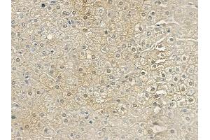 ABIN6261513 and ABIN6269183 at 1/100 staining human normal liver tissue by IHC-P.