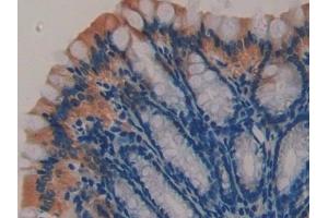 Detection of CNTNAP4 in Mouse Small intestine Tissue using Polyclonal Antibody to Contactin-associated protein-like 4 (CNTNAP4)