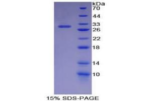 SDS-PAGE analysis of Mouse IKBIP Protein.