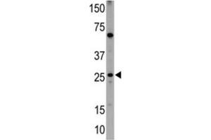 Western Blotting (WB) image for anti-BCL2/adenovirus E1B 19kDa Interacting Protein 1 (BNIP1) (BH3 Domain) antibody (ABIN2997180) (BNIP1 anticorps  (BH3 Domain))