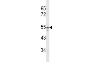 Western blot analysis of NAMPT antibody and A375 lysate (NAMPT anticorps  (AA 400-426))