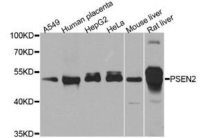 Western blot analysis of extracts of various cell lines, using PSEN2 antibody.