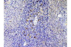 IHC analysis of IL12B using anti-IL12B antibody .