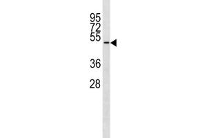 Western Blotting (WB) image for anti-Tubulin, delta 1 (TUBD1) antibody (ABIN3004521) (TUBD1 anticorps)