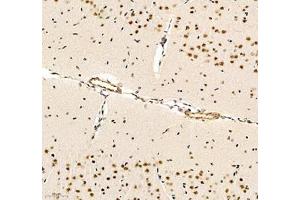 Immunohistochemistry of paraffin embedded rat brain using notch3 (ABIN7074862) at dilution of 1:700 (200x lens)