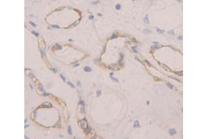 Figure. (CD93 anticorps  (AA 227-493))