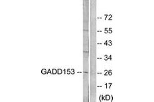 Western blot analysis of extracts from LOVO cells, treated with serum 10% 15', using GADD153 Antibody.