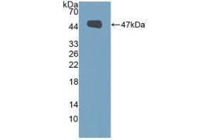 Western blot analysis of recombinant Human MUC1. (MUC1 anticorps  (AA 1098-1255))