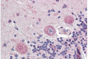 Brain, cerebellum, Human: Formalin-Fixed, Paraffin-Embedded (FFPE)