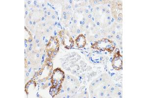 Immunohistochemistry of paraffin-embedded rat kidney using TMED3 antibody (ABIN7270944) at dilution of 1:100 (40x lens).