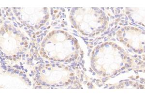 Detection of ANP32A in Human Colon Tissue using Polyclonal Antibody to Acidic Nuclear Phosphoprotein 32 Family, Member A (ANP32A)