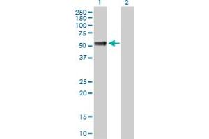 Western Blot analysis of OSMR expression in transfected 293T cell line by OSMR MaxPab polyclonal antibody. (Oncostatin M Receptor anticorps  (AA 1-342))