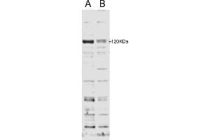 Western Blotting (WB) image for anti-DCN1, Defective in Cullin Neddylation 1, Domain Containing 2 (DCUN1D2) (N-Term) antibody (ABIN2774501)