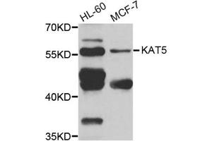 Western Blotting (WB) image for anti-K(lysine) Acetyltransferase 5 (KAT5) antibody (ABIN1980157) (KAT5 anticorps)