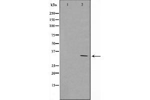 Western blot analysis on Jurkat cell lysate using Cyclin G Antibody,The lane on the left is treated with the antigen-specific peptide. (Cyclin G1 anticorps  (Internal Region))