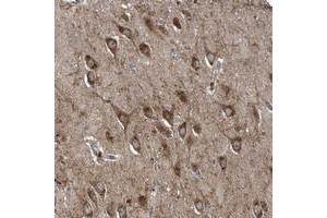 Immunohistochemical staining of human hippocampus with LYRM4 polyclonal antibody  shows strong cytoplasmic positivity in neuronal cells at 1:50-1:200 dilution. (LYRM4 anticorps)