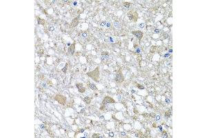 Immunohistochemistry of paraffin-embedded rat brain using VPS37A antibody at dilution of 1:100 (x40 lens). (VPS37A anticorps)