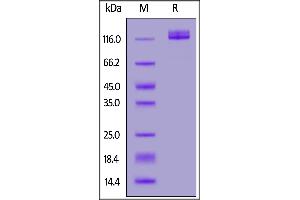 Human ENPP3, His Tag on  under reducing (R) condition. (ENPP3 Protein (AA 48-875) (His tag))