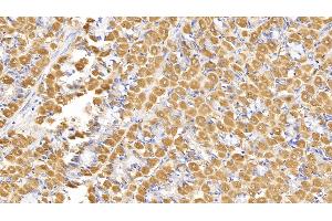 Detection of SEMA5B in Human Stomach Tissue using Monoclonal Antibody to Semaphorin 5B (SEMA5B)