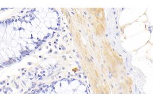 Detection of JAK3 in Human Colon Tissue using Polyclonal Antibody to Janus Kinase 3 (JAK3)