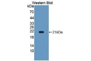 Detection of Recombinant RBM3, Human using Polyclonal Antibody to RNA Binding Motif Protein 3 (RBM3) (RBM3 anticorps  (AA 1-157))