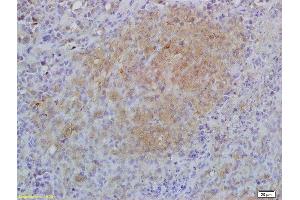 Formalin-fixed and paraffin embedded mouse lymphoma labeled with Anti-IL-17RA/CD217 Polyclonal Antibody, Unconjugated (ABIN747908) at 1:200 followed by conjugation to the secondary antibody and DAB staining (IL17RA anticorps  (AA 201-300))