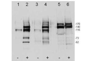 Western blot using ’s affinity purified anti-c-Met pY1349pY1356 antibody shows detection of phosphorylated c-Met. (c-MET anticorps  (pTyr1249, pTyr1356))