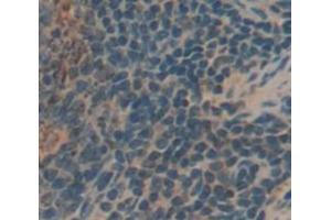 IHC-P analysis of Human Tissue, with DAB staining. (KIR2DS4 anticorps  (AA 22-302))