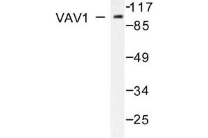 Image no. 2 for anti-Vav 1 Oncogene (VAV1) antibody (ABIN271858) (VAV1 anticorps)