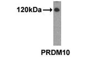 Western analysis of extracts from 293 cells using PRDM10 antibody. (PRDM10 anticorps  (N-Term))
