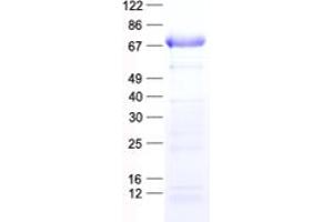 Validation with Western Blot