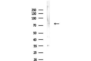 anti-Amphiphysin (AMPH) (Internal Region) antibody