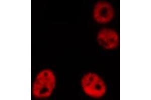 ABIN6276866 staining HeLa cells by IF/ICC.