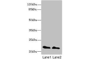Western blot All lanes: KRAS antibody at 2 μg/mL Lane 1: Mouse brain tissue Lane 2: Mouse kidney tissue Secondary Goat polyclonal to rabbit IgG at 1/10000 dilution Predicted band size: 22 kDa Observed band size: 22 kDa (K-RAS anticorps  (AA 2-168))