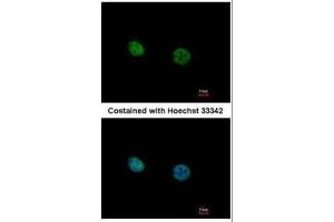 ICC/IF Image Immunofluorescence analysis of paraformaldehyde-fixed HeLa, using NR2C2, antibody at 1:500 dilution. (TR4 anticorps)