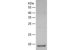 Western Blotting (WB) image for Zinc and Ring Finger Protein 1 (ZNRF1) (AA 74-178) protein (His tag) (ABIN7125764)