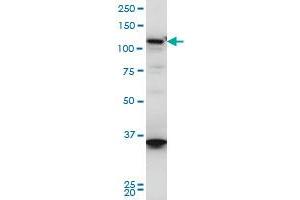 HIP1R monoclonal antibody (M01), clone 3E10 Western Blot analysis of HIP1R expression in A-431 . (HIP1R anticorps  (AA 969-1066))