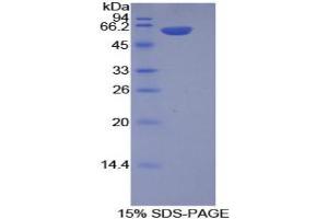 SDS-PAGE analysis of Mouse Integrin alpha 9 Protein. (ITGA9 Protéine)