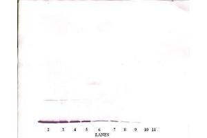 Image no. 2 for anti-Interferon gamma (IFNG) antibody (ABIN464926) (Interferon gamma anticorps)