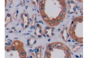 Detection of ErbB2 in Human Kidney Tissue using Polyclonal Antibody to Receptor Tyrosine Protein Kinase erbB-2 (ErbB2)